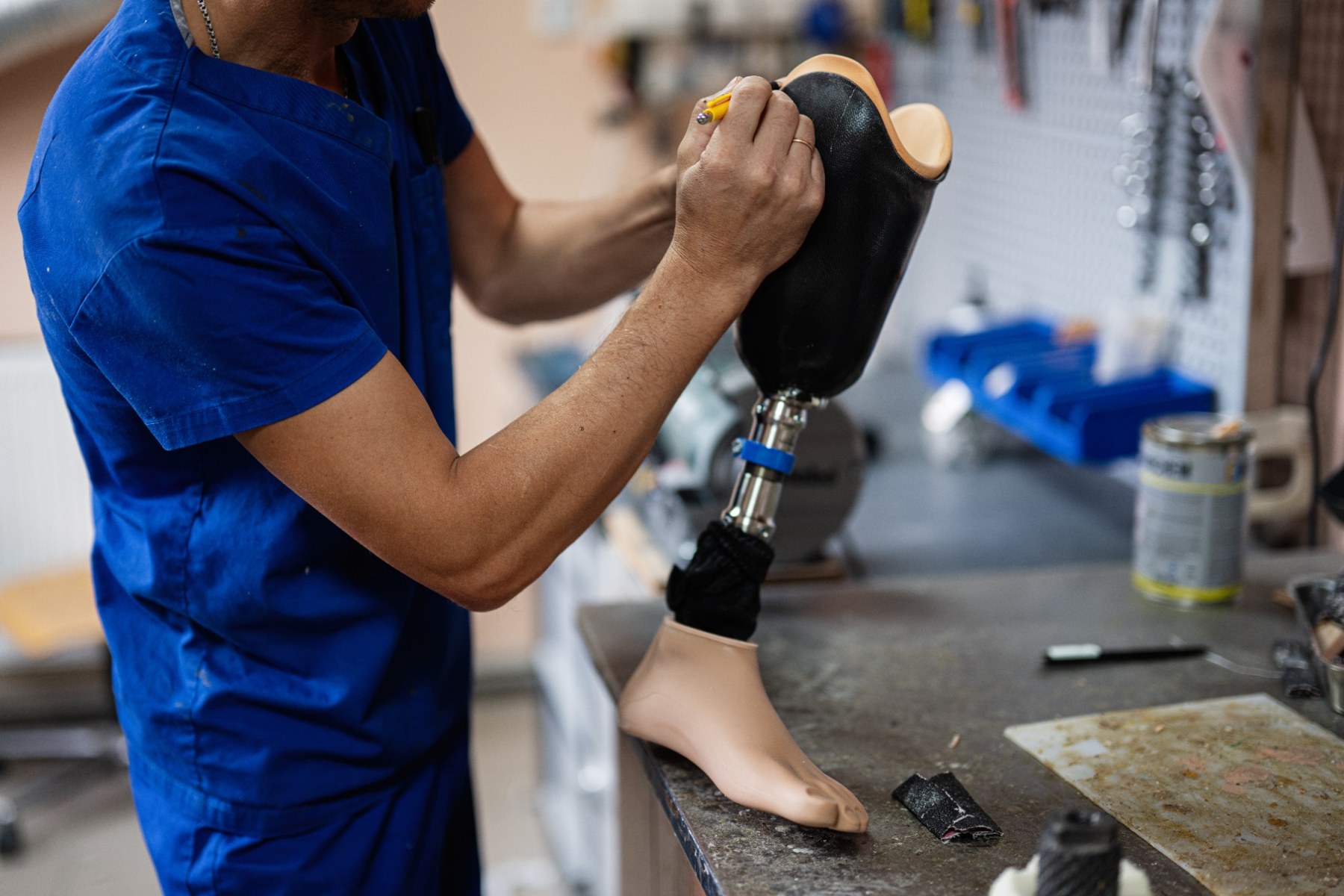 Custom Prosthetics
